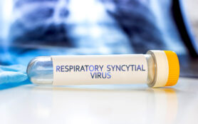 Respiratory,Syncytial,Virus,With,Lung,Ct,Scan,Aside,On,Light