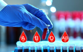 Doctor,Determining,Blood,Groups,Of,Samples,In,Laboratory,,Closeup