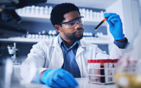 Science,,Blood,And,Black,Man,In,Laboratory,With,Sample,For